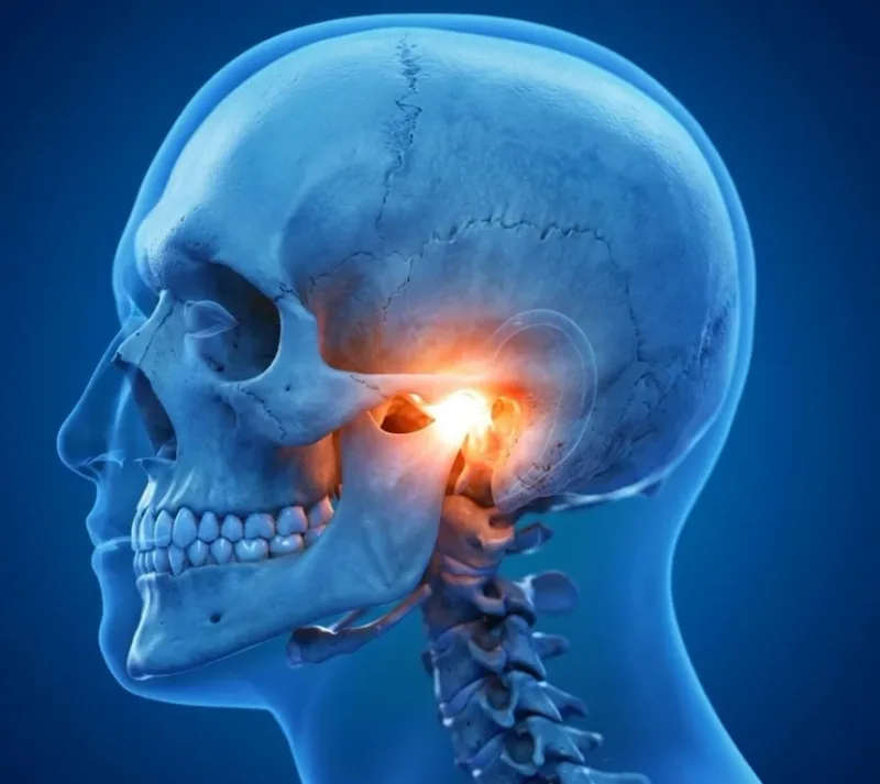 Educational skull illustration highlighting the jaw joint beside the ear