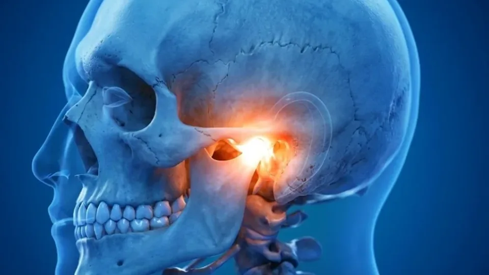 Illustration representing jaw pain, clicking and temporomandibular joint disorders